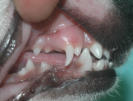 Zahnwechsel mit Milchzahn und bleibenden Zahn gleichzeitig 