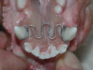 Zahnregulierung Hund im Unterkiefer